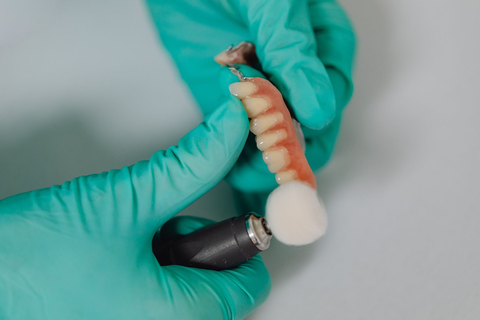 Single Dental Implants vs. Fixed Bridges: Which Option Is Right for You?