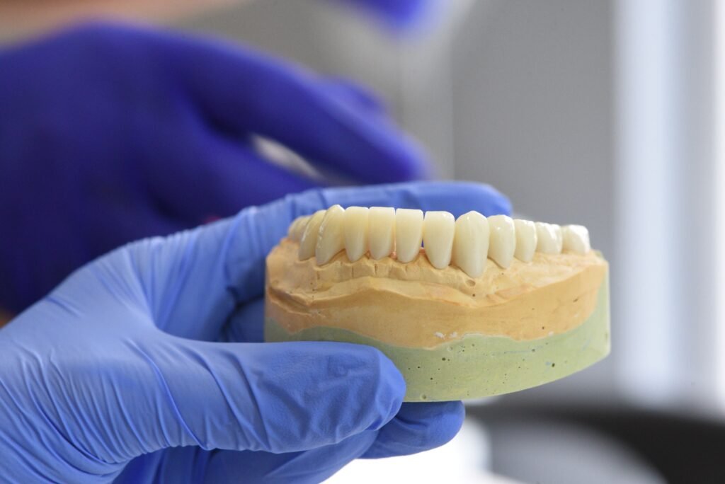 What to Know Before Getting Dental Implants in Erode