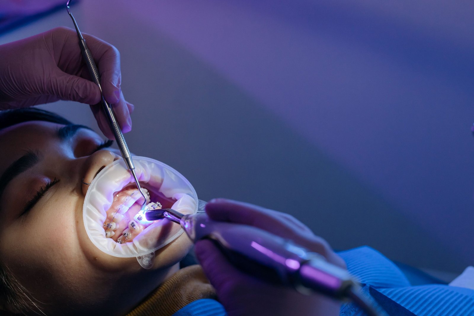 Dental Hospital In Erode For Teeth Braces