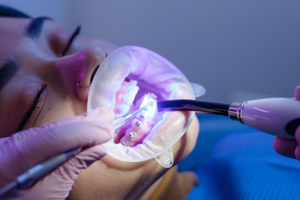 Care tips after wearing braces erode