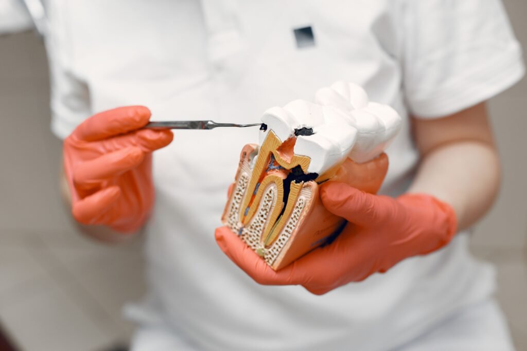 How long does root canal pain last in Erode