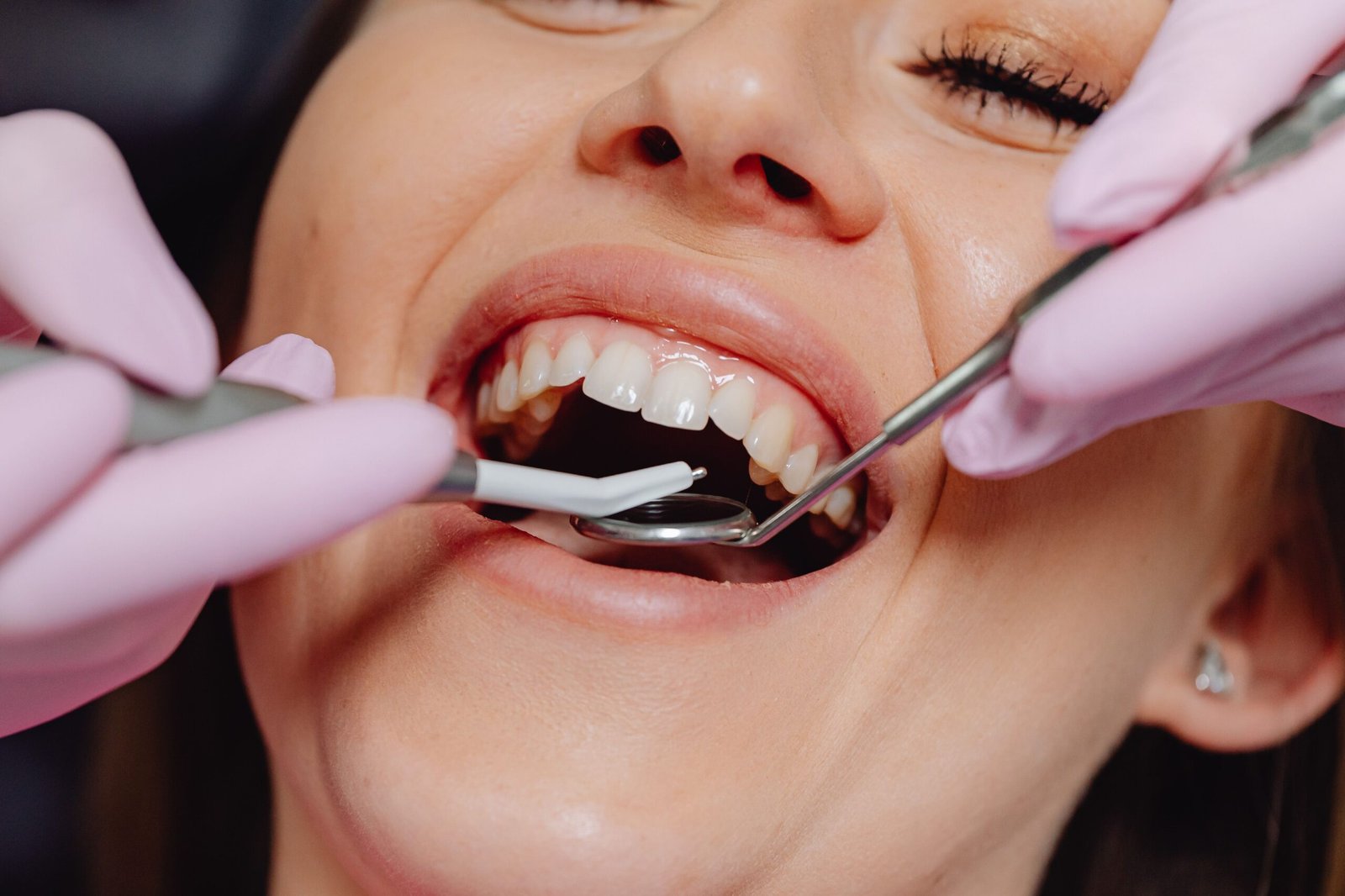 How Often Should You Visit a Dentist for a Routine Dental Checkup?
