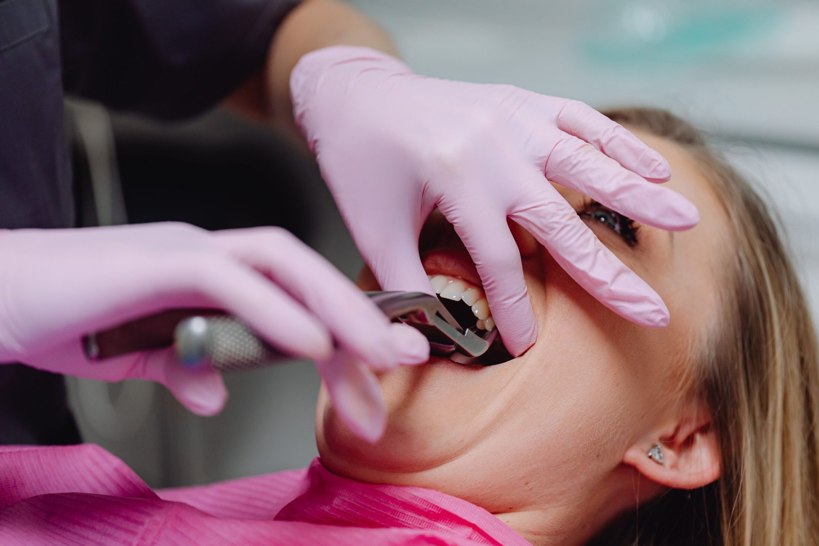 Food to Eat After Tooth Extraction Erode Dentist Advice