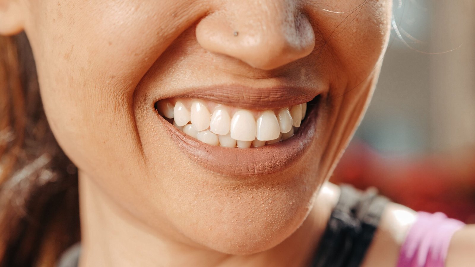 Best Cosmetic Dentist in Erode for Smile Makeovers