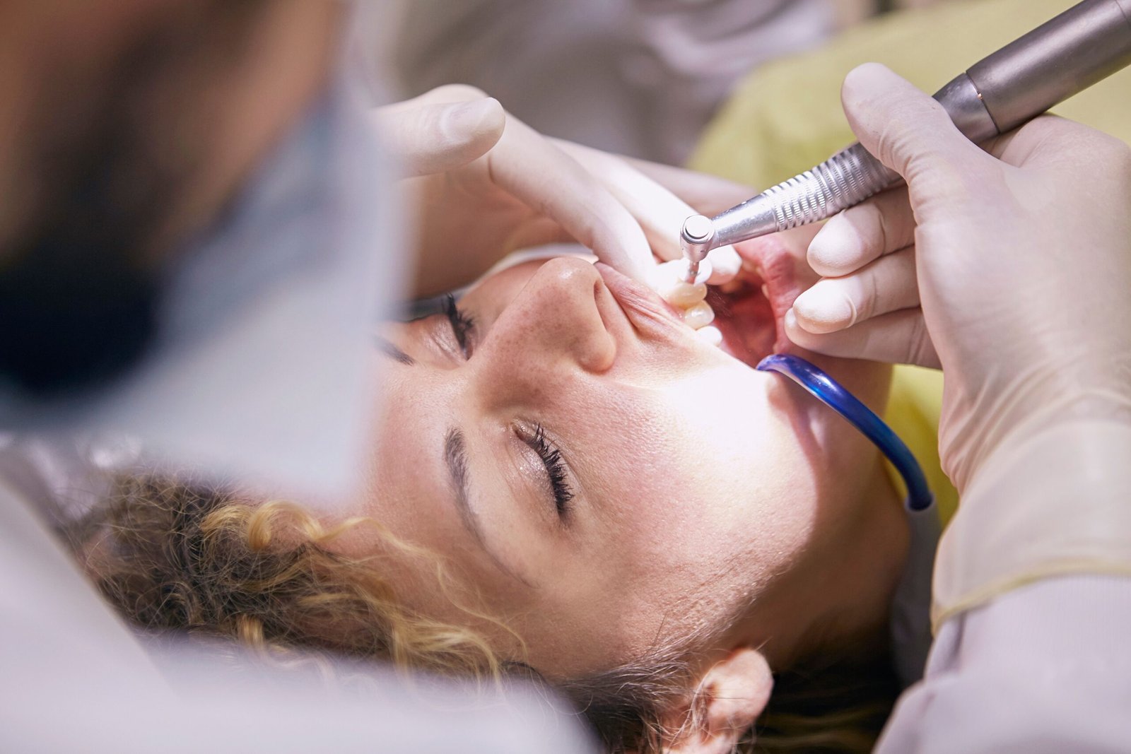 Painless Root Canal Treatment in Erode: Debunking the Biggest Myths